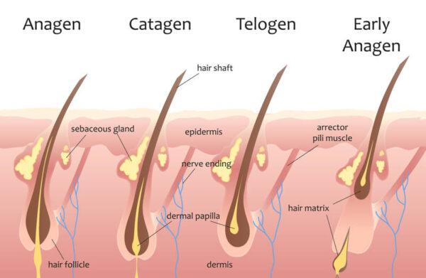 Hair Miniaturization What Is It 8 Ways To Help Stop It Hairguard