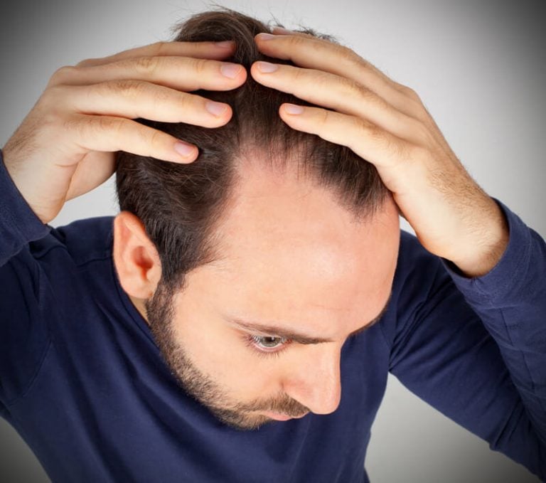 Hair Miniaturization What is it & 8 Ways to Help Stop It Hairguard