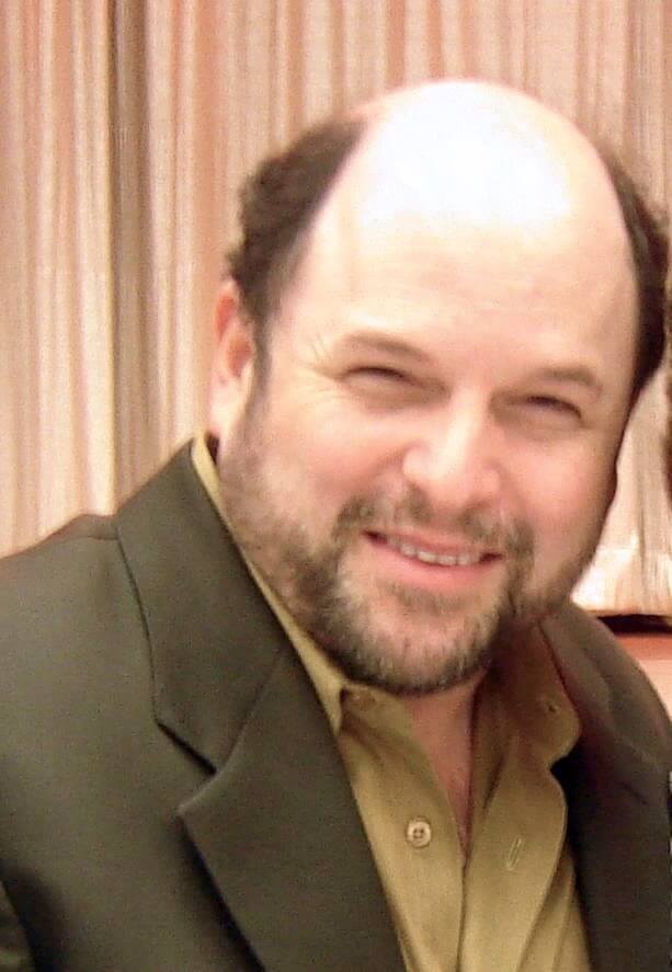 Jason Alexander with a stage 7 hairline