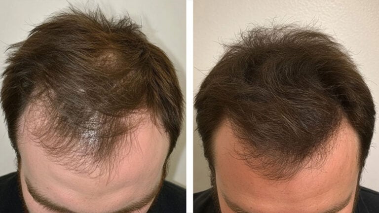 Andrew before and after