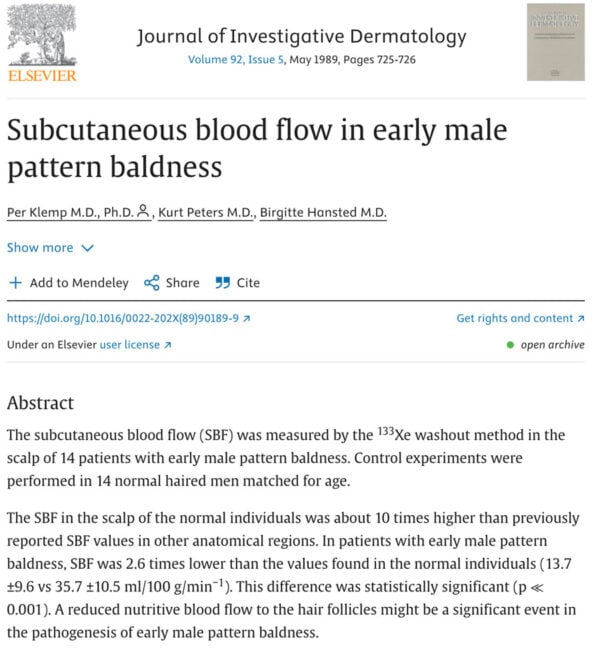 Hairloss research paper
