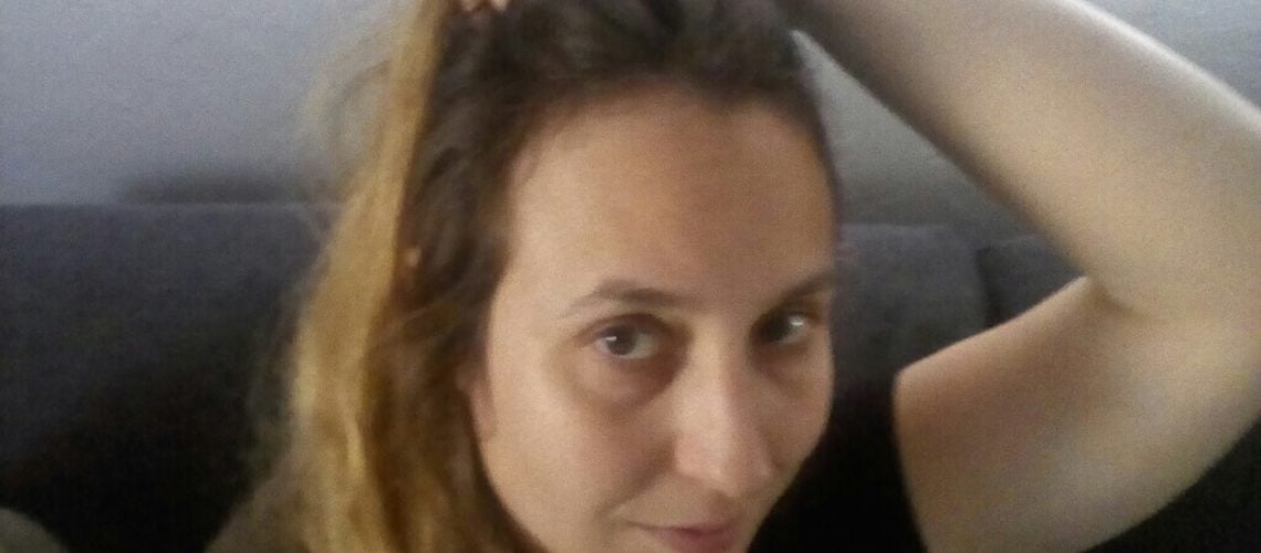 Nutrafol Review 2020 Real User Pictures Hairguard
